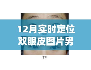 雙眼皮蛻變之旅，從學習到自信的華麗轉(zhuǎn)身，實時定位雙眼皮圖片男展示十二月的蛻變歷程