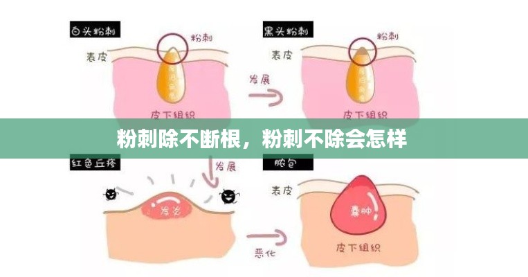 粉刺除不斷根，粉刺不除會(huì)怎樣 