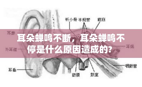 耳朵蟬鳴不斷，耳朵蟬鳴不停是什么原因造成的? 