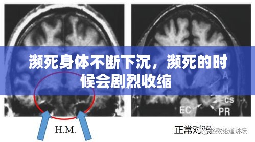 瀕死身體不斷下沉，瀕死的時(shí)候會(huì)劇烈收縮 