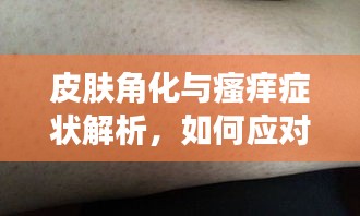 皮膚角化與瘙癢癥狀解析，如何應對角化帶來的困擾？