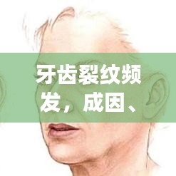 牙齒裂紋頻發(fā)，成因、影響及應對良方